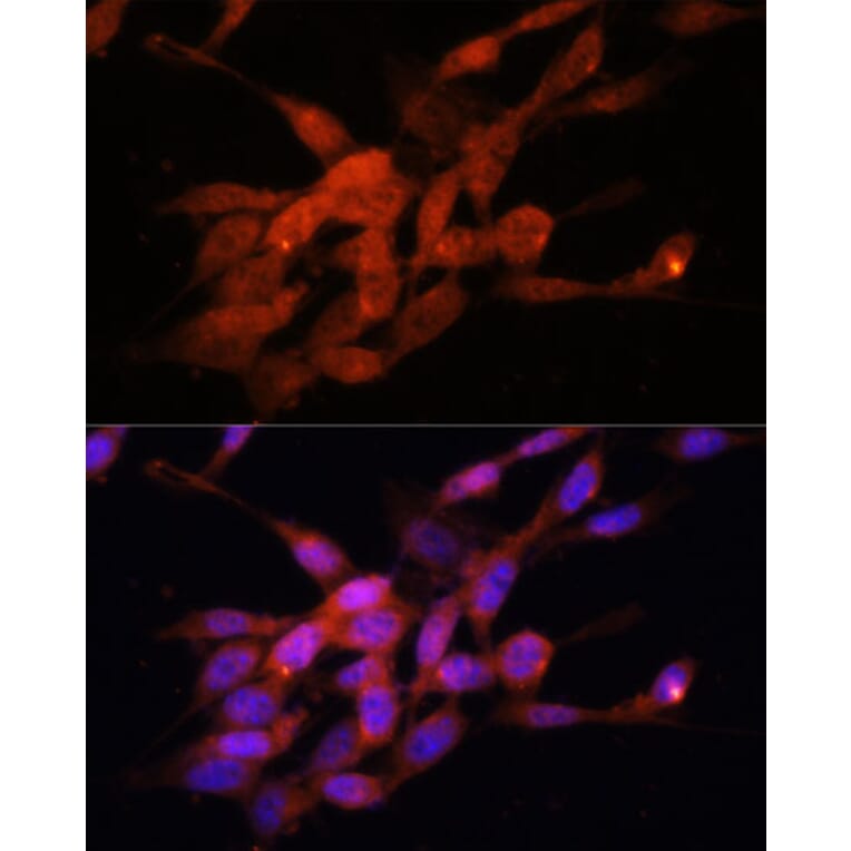 Immunofluorescence - Anti-PGC1 alpha Antibody (A80615) - Antibodies.com