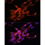 Immunofluorescence - Anti-PGC1 alpha Antibody (A80615) - Antibodies.com