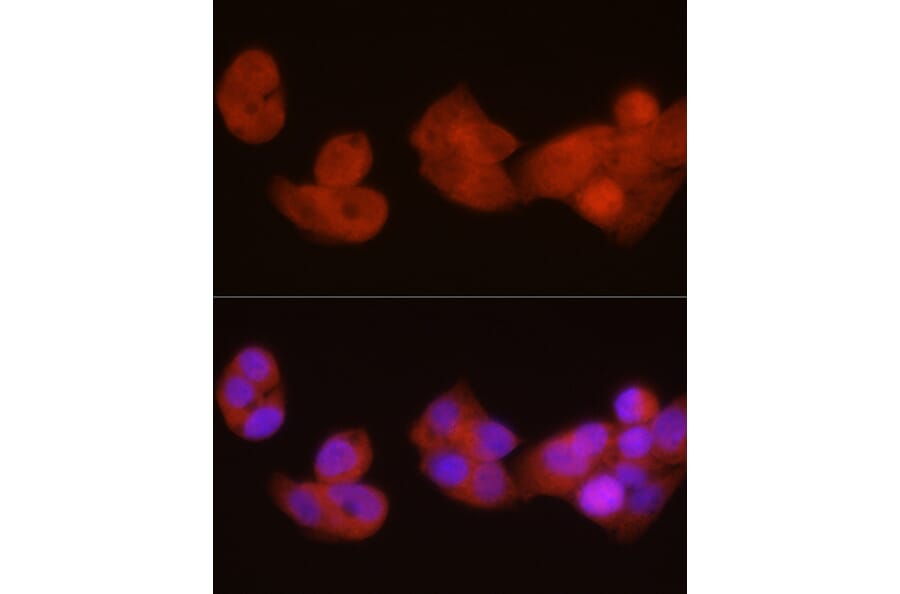 Immunofluorescence - Anti-PGC1 alpha Antibody (A80615) - Antibodies.com