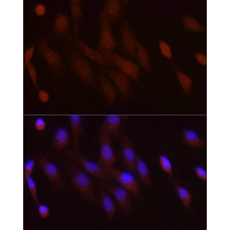 Immunofluorescence - Anti-PGC1 alpha Antibody (A80615) - Antibodies.com