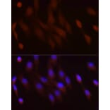 Immunofluorescence - Anti-PGC1 alpha Antibody (A80615) - Antibodies.com