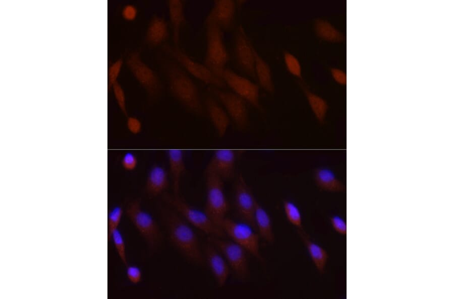 Immunofluorescence - Anti-PGC1 alpha Antibody (A80615) - Antibodies.com