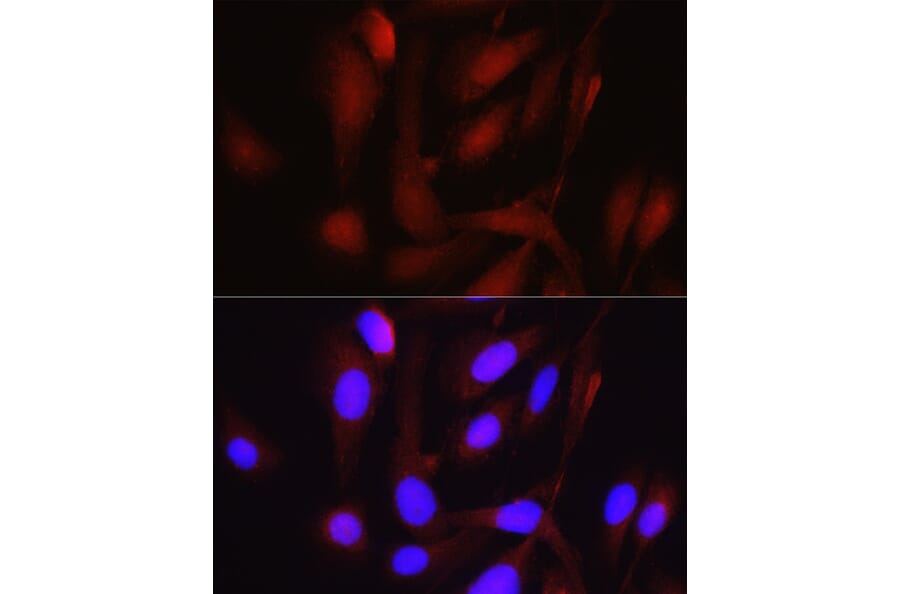 Immunofluorescence - Anti-PGC1 alpha Antibody (A80615) - Antibodies.com