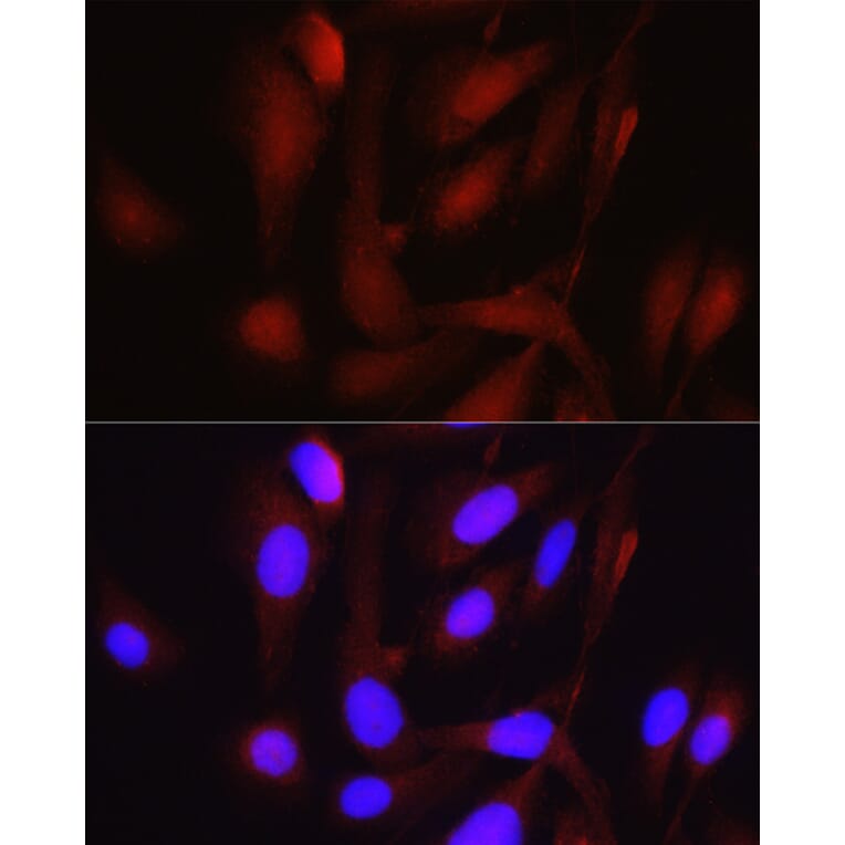 Immunofluorescence - Anti-PGC1 alpha Antibody (A80615) - Antibodies.com