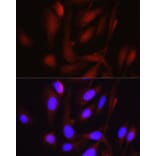 Immunofluorescence - Anti-PGC1 alpha Antibody (A80615) - Antibodies.com