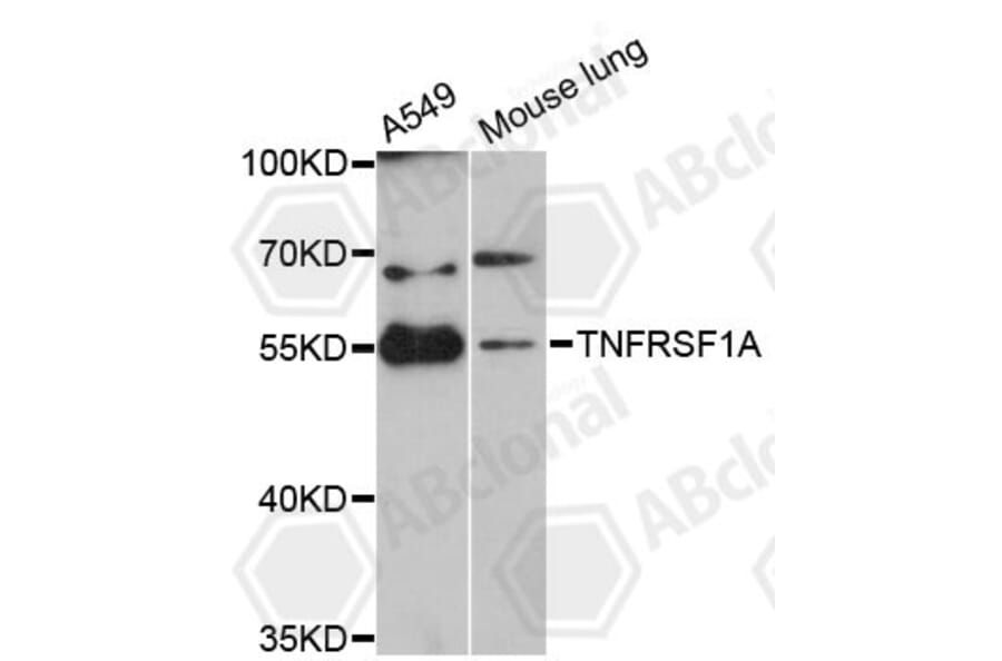 Immunofluorescence - Anti-TNFRSF1A Antibody (A0033) - Antibodies.com