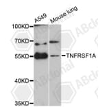 Immunofluorescence - Anti-TNFRSF1A Antibody (A0033) - Antibodies.com