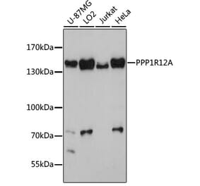 Western Blot - Anti-Myosin Phosphatase Antibody (A80617) - Antibodies.com