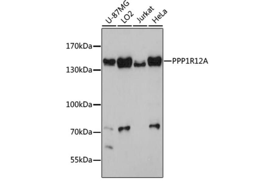 Western Blot - Anti-Myosin Phosphatase Antibody (A80617) - Antibodies.com