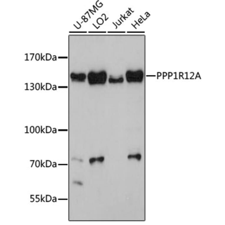 Western Blot - Anti-Myosin Phosphatase Antibody (A80617) - Antibodies.com