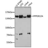 Western Blot - Anti-Myosin Phosphatase Antibody (A80617) - Antibodies.com