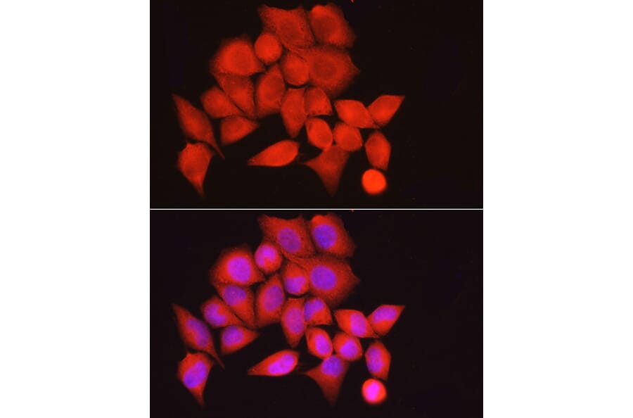 Immunofluorescence - Anti-Myosin Phosphatase Antibody (A80617) - Antibodies.com