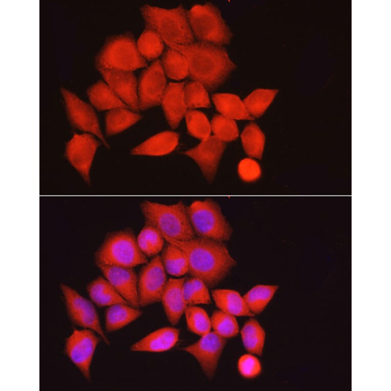 Immunofluorescence - Anti-Myosin Phosphatase Antibody (A80617) - Antibodies.com