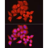 Immunofluorescence - Anti-Myosin Phosphatase Antibody (A80617) - Antibodies.com