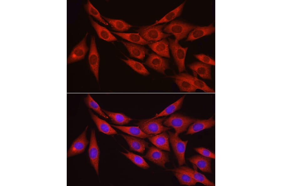 Immunofluorescence - Anti-Myosin Phosphatase Antibody (A80617) - Antibodies.com