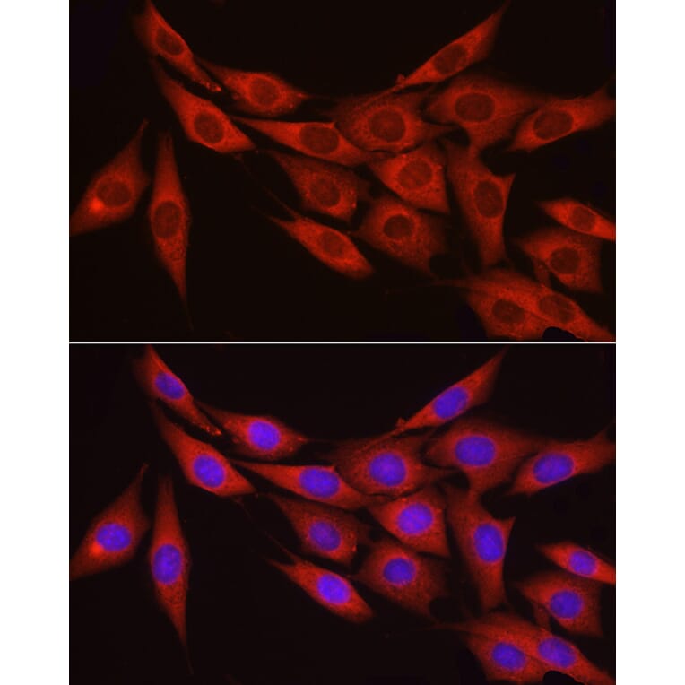 Immunofluorescence - Anti-Myosin Phosphatase Antibody (A80617) - Antibodies.com