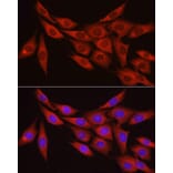 Immunofluorescence - Anti-Myosin Phosphatase Antibody (A80617) - Antibodies.com