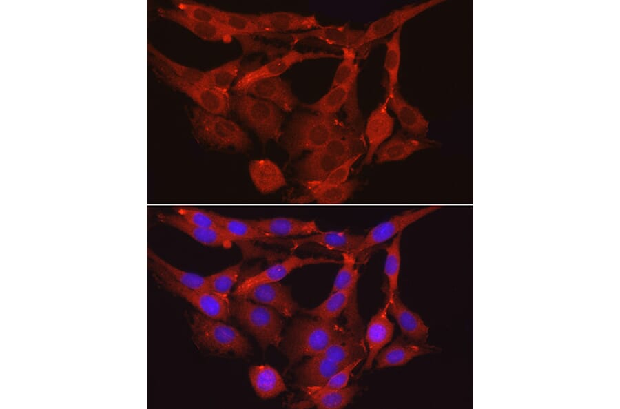 Immunofluorescence - Anti-Myosin Phosphatase Antibody (A80617) - Antibodies.com