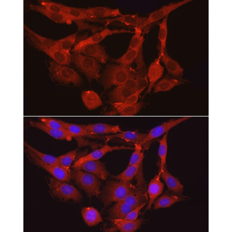 Immunofluorescence - Anti-Myosin Phosphatase Antibody (A80617) - Antibodies.com