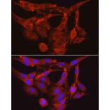 Immunofluorescence - Anti-Myosin Phosphatase Antibody (A80617) - Antibodies.com