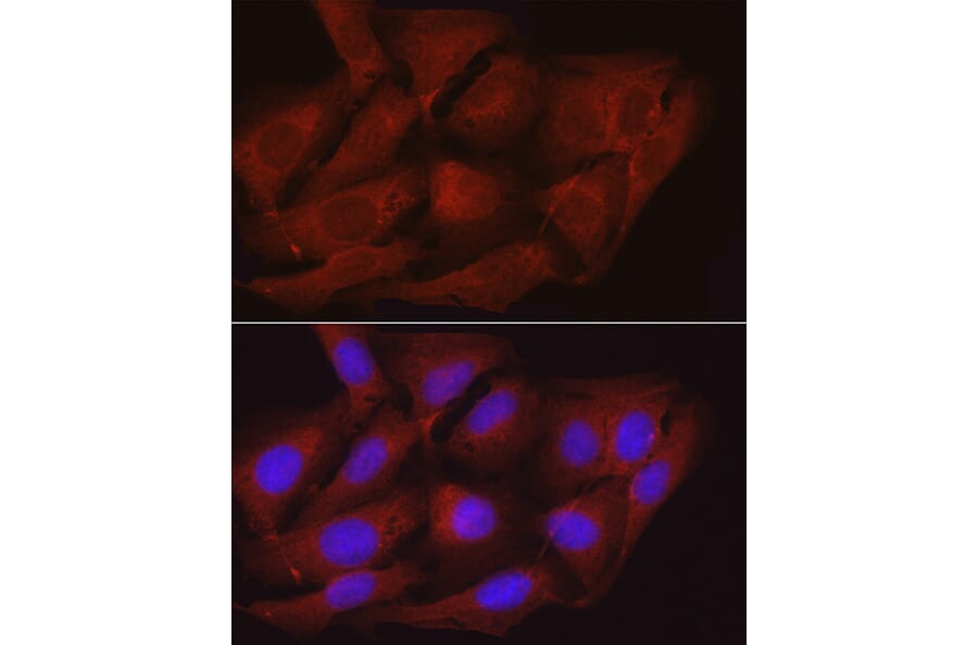 Immunofluorescence - Anti-Myosin Phosphatase Antibody (A80617) - Antibodies.com