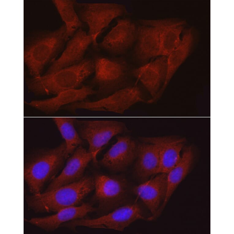 Immunofluorescence - Anti-Myosin Phosphatase Antibody (A80617) - Antibodies.com