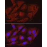 Immunofluorescence - Anti-Myosin Phosphatase Antibody (A80617) - Antibodies.com