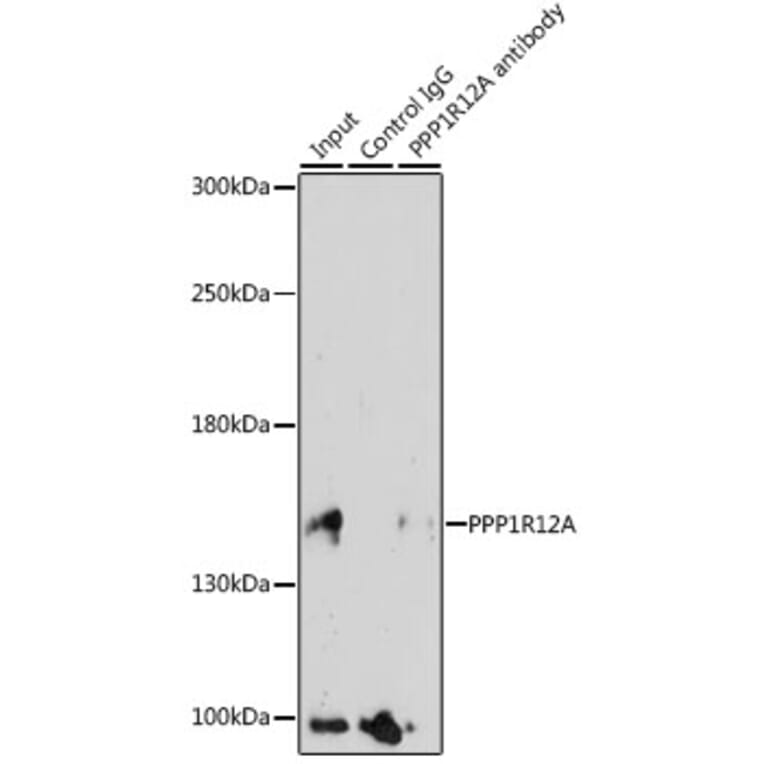 Western Blot - Anti-Myosin Phosphatase Antibody (A80617) - Antibodies.com