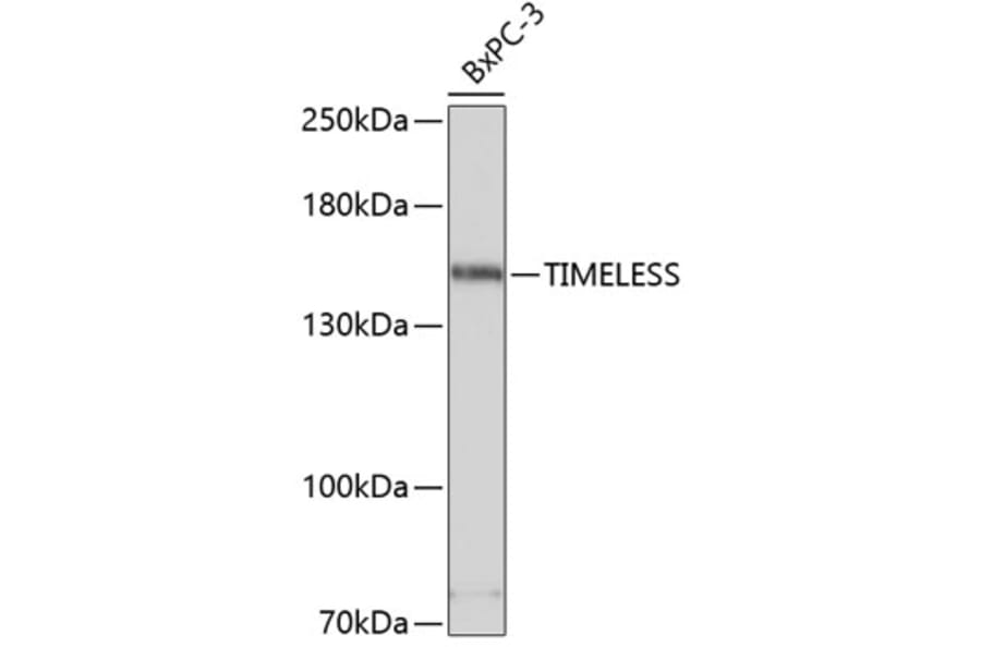 Western Blot - Anti-Timeless Antibody (A80618) - Antibodies.com