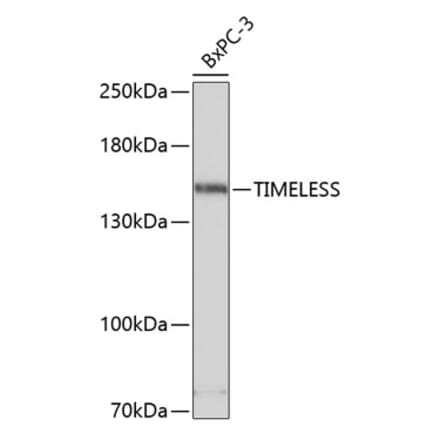 Western Blot - Anti-Timeless Antibody (A80618) - Antibodies.com