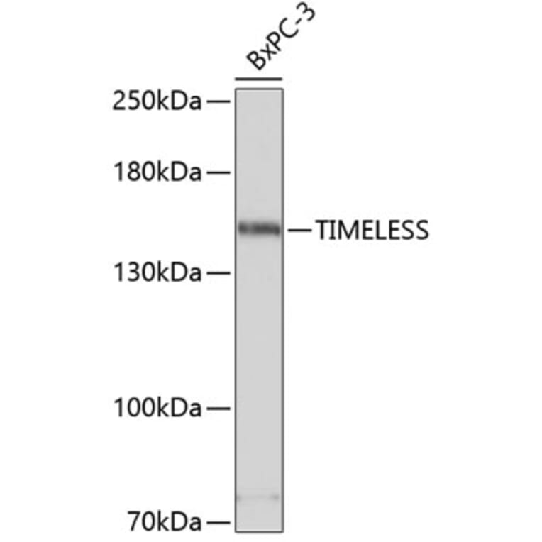 Western Blot - Anti-Timeless Antibody (A80618) - Antibodies.com