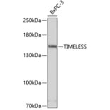 Western Blot - Anti-Timeless Antibody (A80618) - Antibodies.com