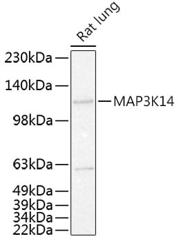Western blot analysis of extracts of Raji cells, using Anti-MAP3K14 Antibody (A11585) at 1:1,000 dilution.
Secondary antibody: Goat Anti-Rabbit IgG (H+L) (HRP) (AS014) at 1:10,000 dilution.
Lysates / proteins: 25µg per lane.
Blocking buffer: 3% non-fat dry milk in TBST.
Detection: ECL Basic Kit (RM00020).
Exposure time: 60s.
