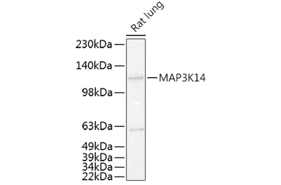 Western Blot - Anti-NFkB Inducing Kinase NIK Antibody (A80619) - Antibodies.com