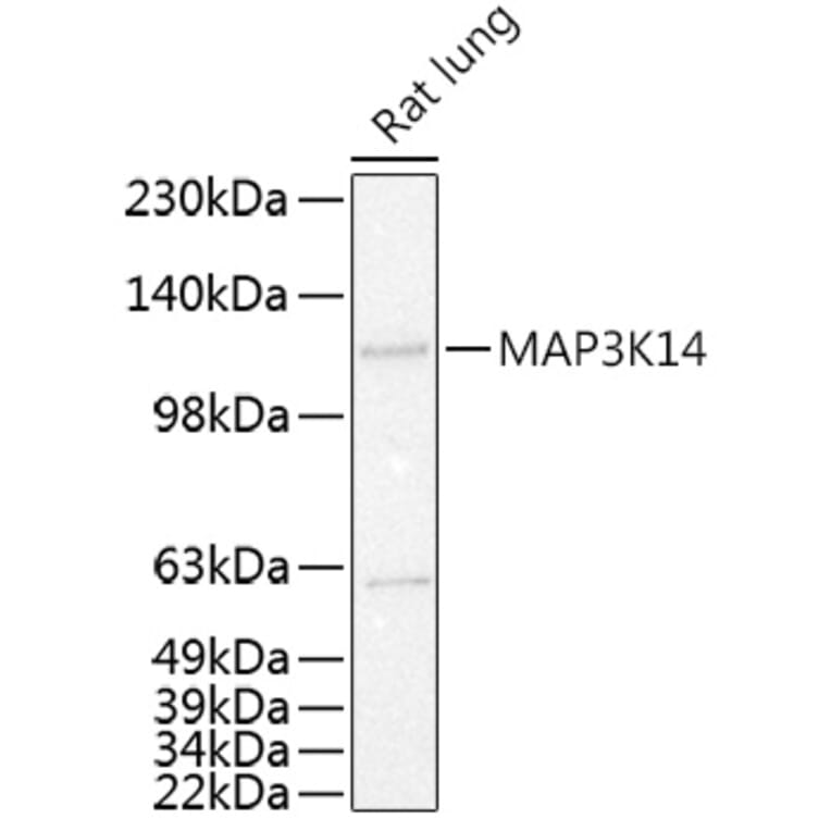 Western Blot - Anti-NFkB Inducing Kinase NIK Antibody (A80619) - Antibodies.com
