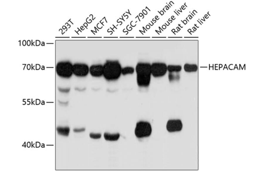 Western Blot - Anti-HEPACAM Antibody (A80620) - Antibodies.com