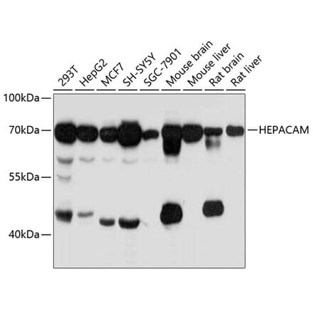 Western Blot - Anti-HEPACAM Antibody (A80620) - Antibodies.com