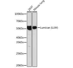 Western Blot - Anti-Lumican Antibody [ARC0637] (A80621) - Antibodies.com