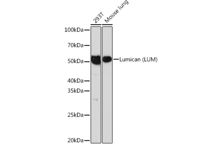 Western Blot - Anti-Lumican Antibody [ARC0637] (A80621) - Antibodies.com