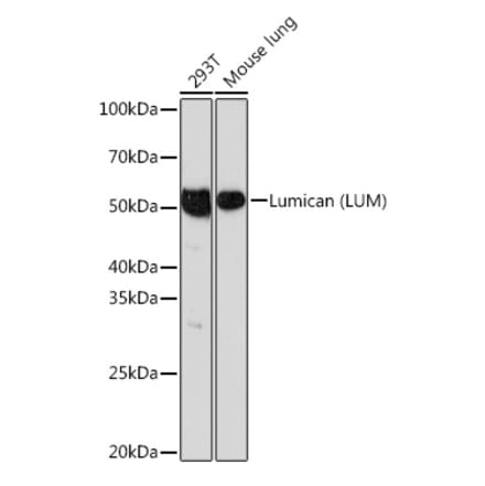 Western Blot - Anti-Lumican Antibody [ARC0637] (A80621) - Antibodies.com