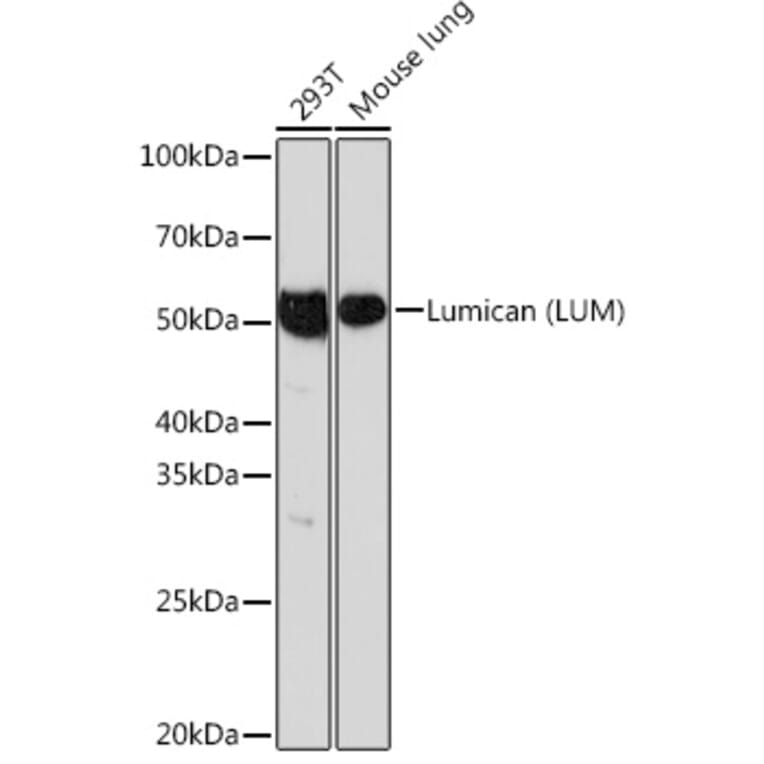 Western Blot - Anti-Lumican Antibody [ARC0637] (A80621) - Antibodies.com