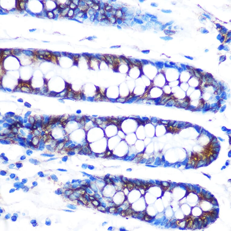 Immunohistochemistry - Anti-Lumican Antibody [ARC0637] (A80621) - Antibodies.com