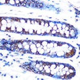 Immunohistochemistry - Anti-Lumican Antibody [ARC0637] (A80621) - Antibodies.com