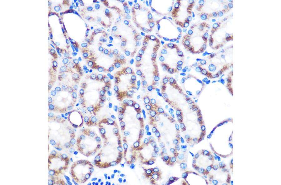 Immunohistochemistry - Anti-Lumican Antibody [ARC0637] (A80621) - Antibodies.com