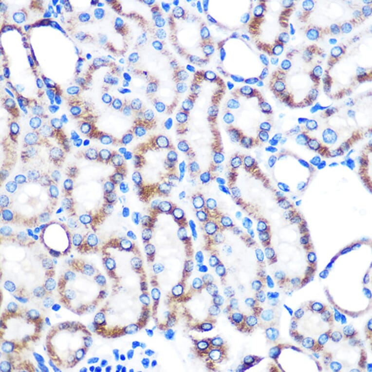 Immunohistochemistry - Anti-Lumican Antibody [ARC0637] (A80621) - Antibodies.com