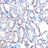 Immunohistochemistry - Anti-Lumican Antibody [ARC0637] (A80621) - Antibodies.com