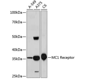 Western Blot - Anti-MC1-R Antibody [ARC0638] (A80622) - Antibodies.com