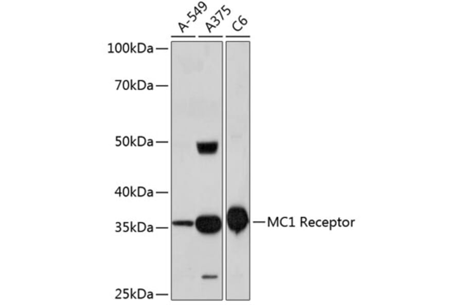 Western Blot - Anti-MC1-R Antibody [ARC0638] (A80622) - Antibodies.com