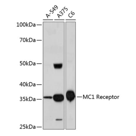 Western Blot - Anti-MC1-R Antibody [ARC0638] (A80622) - Antibodies.com