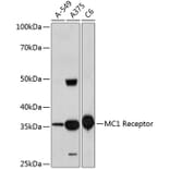 Western Blot - Anti-MC1-R Antibody [ARC0638] (A80622) - Antibodies.com